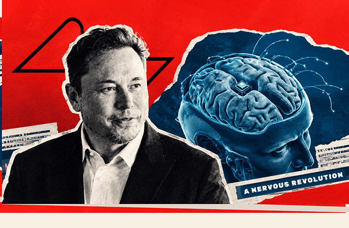 Chips in Skulls and a Nervous Revolution