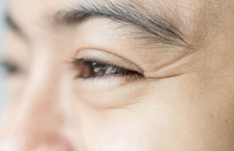 asian man with fine lines