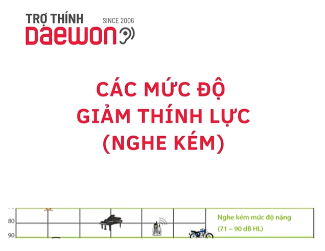 Các mức độ giảm thính lực (nghe kém)