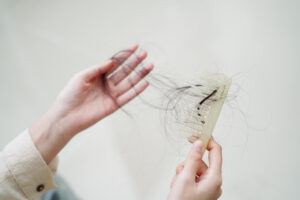 A woman has a problem with long hair loss attach to comb brush due to hormonal changes and medical conditions