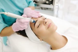 Skin Discoloration Treatment: Microdermabrasion