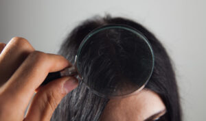 examines hair young woman with magnifying glass