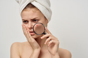 Disadvantages of Cold Showers for Acne