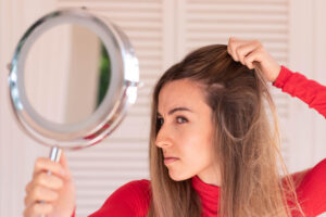 A woman is thinning on top of the head