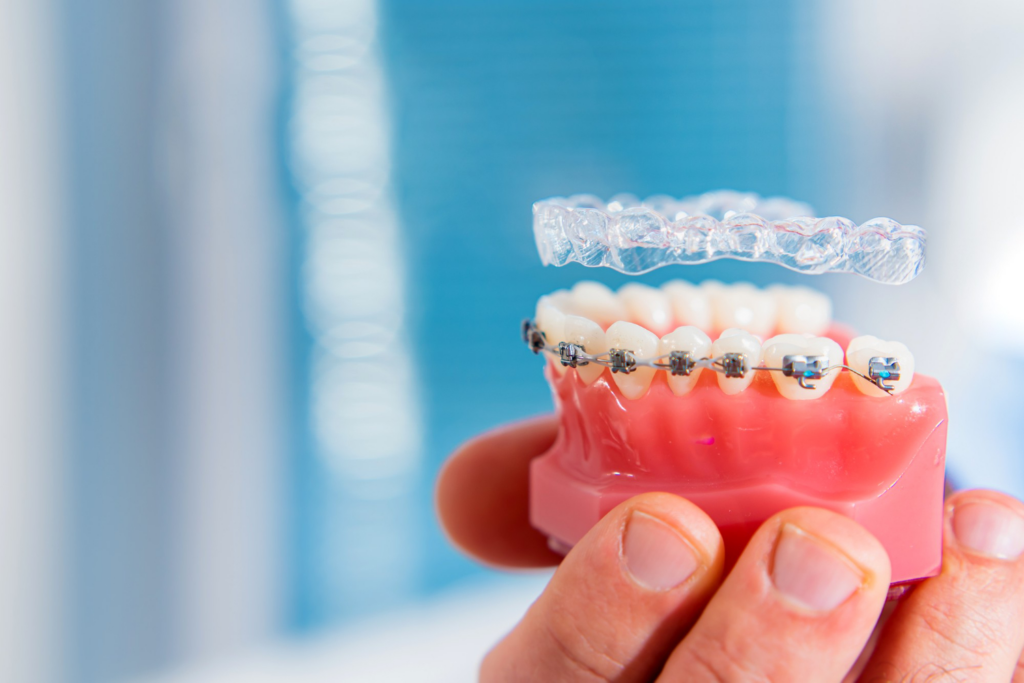What are Permanent Retainers?