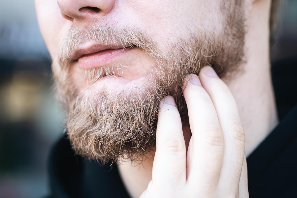 Best Products for Itchy Beard