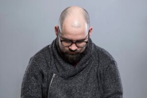 Beard with a Bald Head