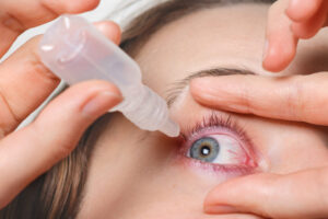 Eye drops