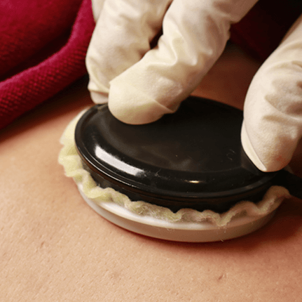 Meridian Tong Acupoint Conditioning and TCM MUD Moxibustion