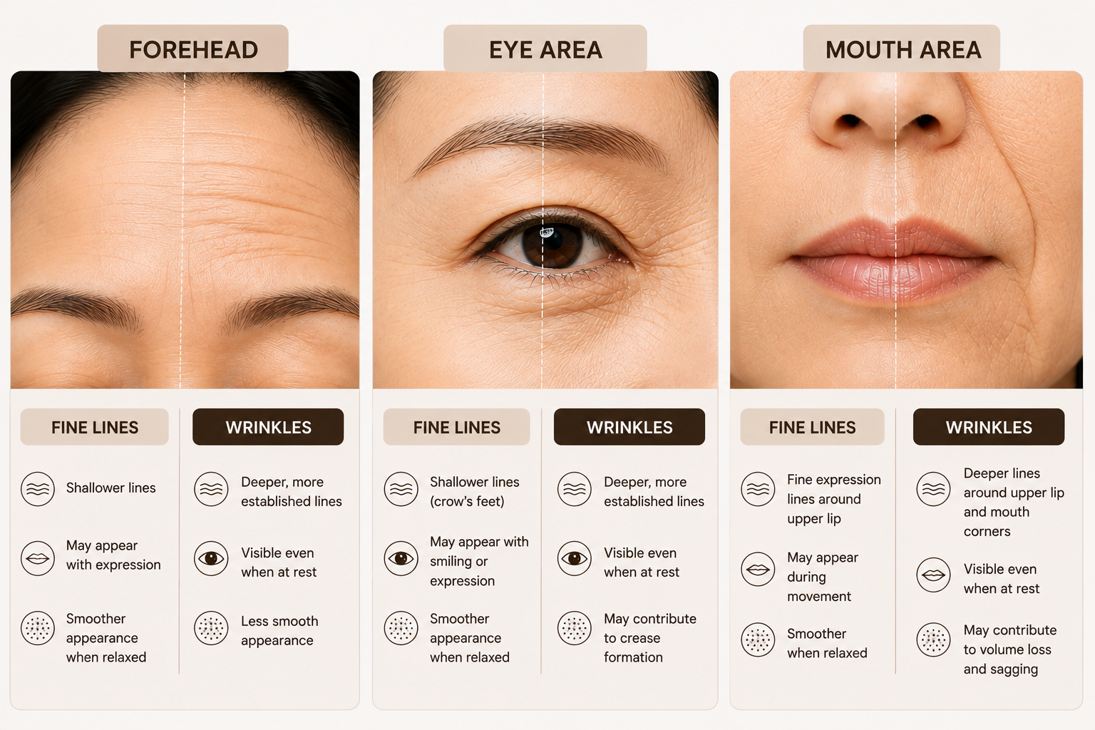 Comparison of fine lines and wrinkles on the forehead, around the eyes and mouth area