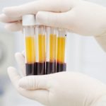COVID-19 - 100 patients in Saudi Arabia treated with blood plasma