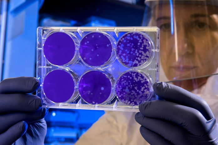 Ilmuan Rusia temukan bakteri pencerna bioplastik di zona permafrost