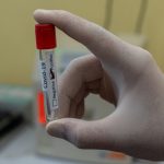 COVID-19 – Lebih 28,5 juta penduduk Indonesia dapat vaksinasi dosis lengkap