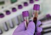 Tes darah dapat deteksi kanker pada orang dengan 'gejala nonspesifik'