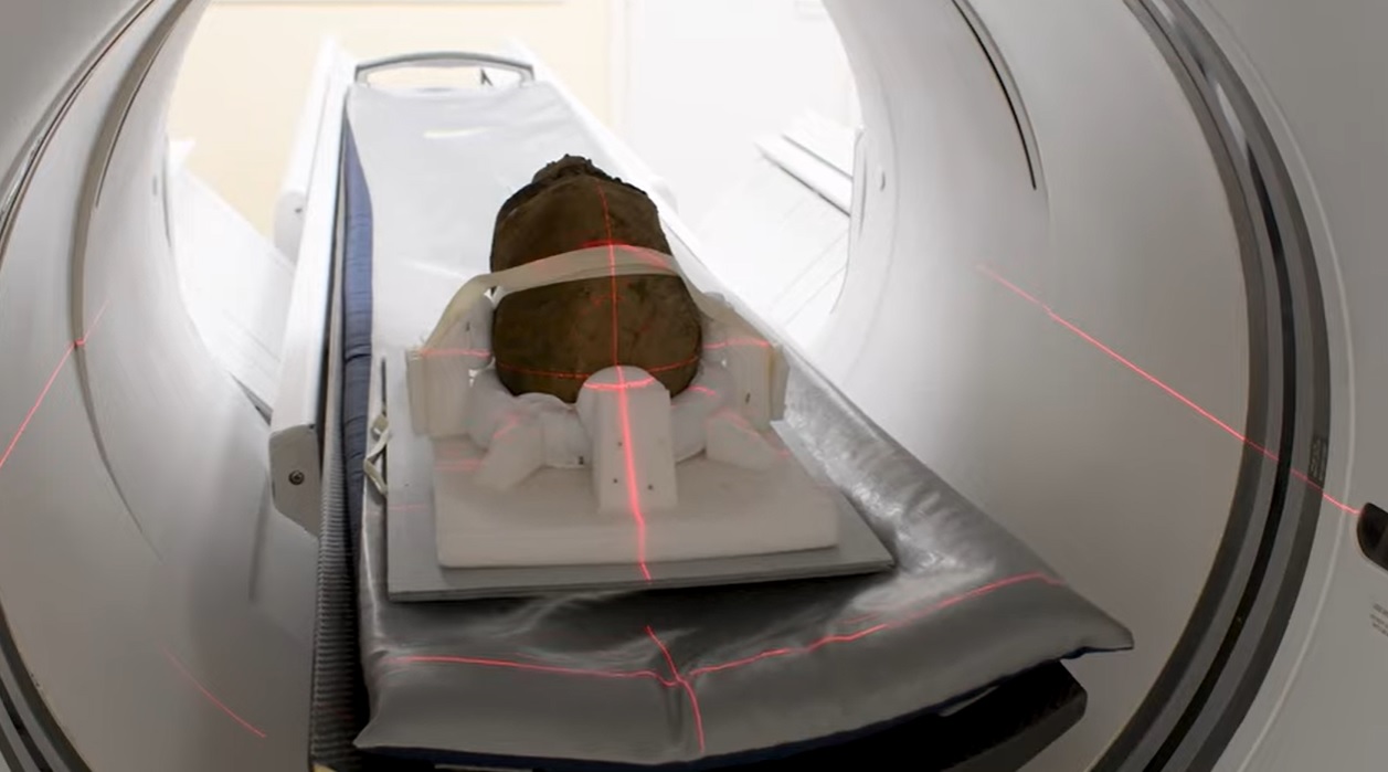 Penggalan kepala mumi Mesir jalani CT scan guna temukan asal-usulnya