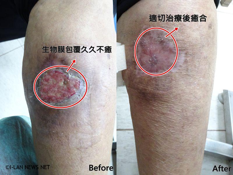 婦女被寵物豬咬傷 傷口潰爛不癒爆風險