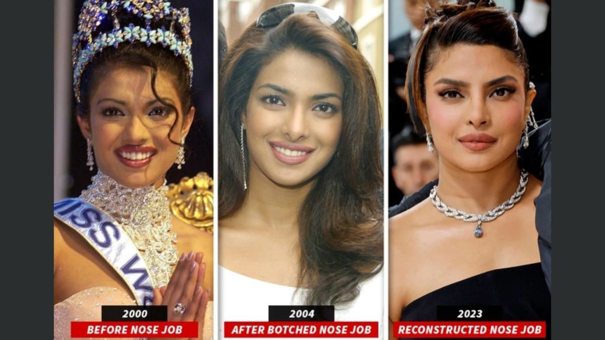 Priyanka Chopra nose job through the years