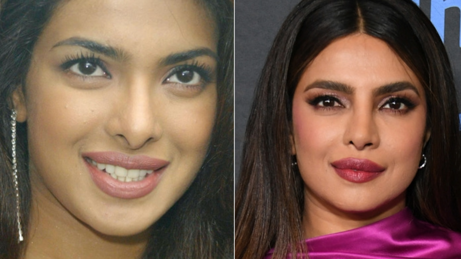 Priyanka Chopra before and after her nose job
