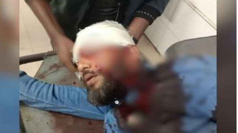 খুলনায় এনসিপি নেতাকে প্রকাশ্যে গুলি, অবস্থা ‘আশঙ্কাজনক’