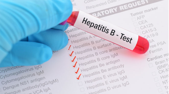 Ilustrasi-Hepatitis-B