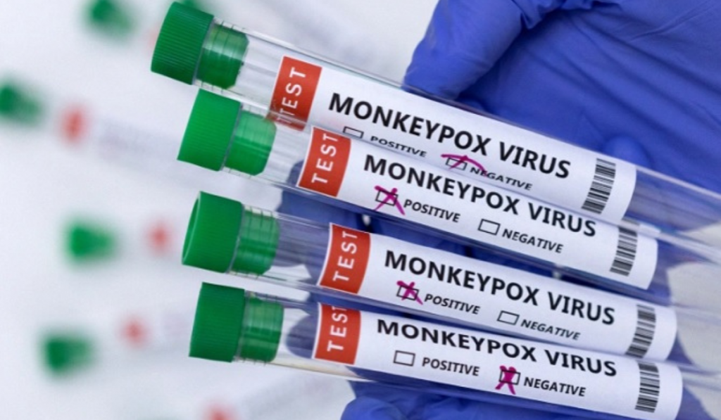 Ilustrasi sampel hasil tes penyakit cacar monyet (Dado Ruvic/Reuters)