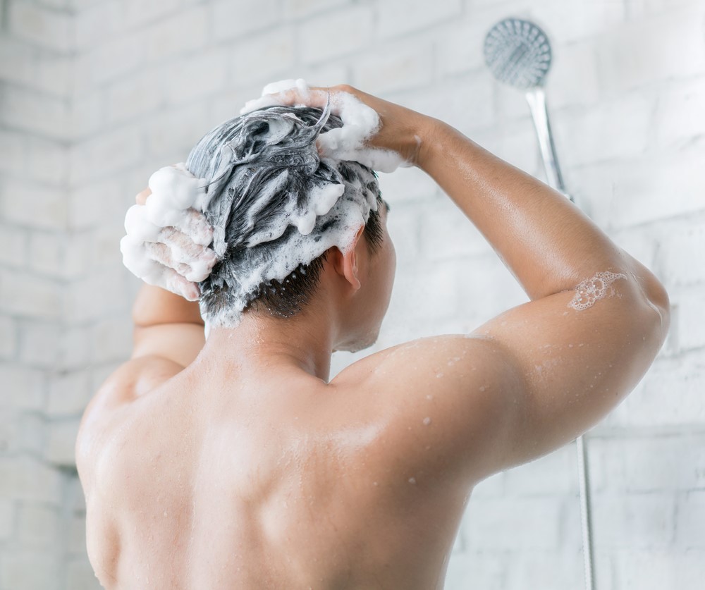 雄性禿有救嗎？可使用合適的頭髮稀疏洗髮精來解決