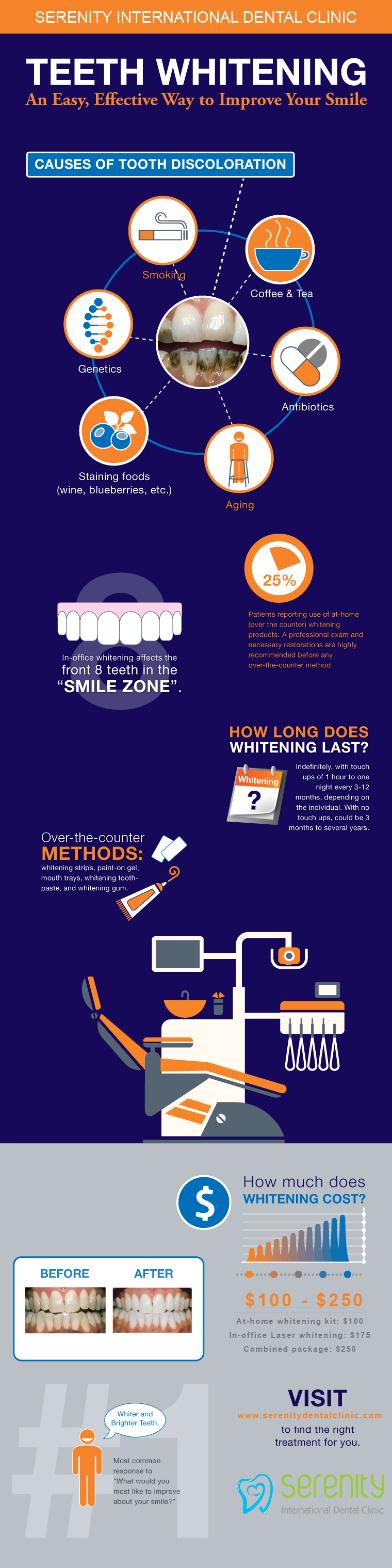 Teeth Whitening - An Easy, Effective Way To Improve Your ...