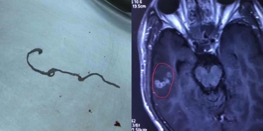 Derita Sejak Tahun 1989, Lelaki Tak Sangka Rupanya Ada 